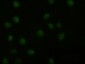 AKT3 Antibody (clone 9H8)